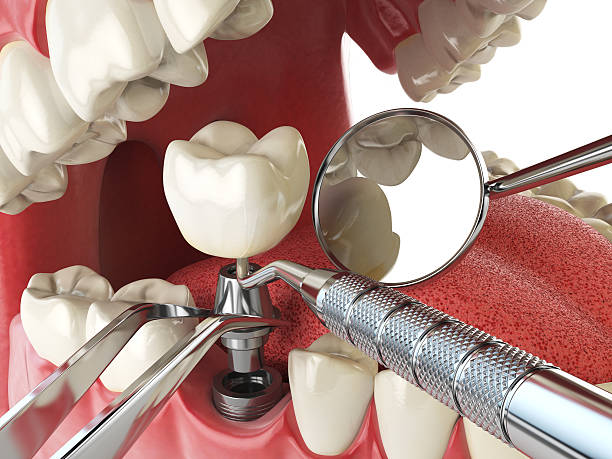 Best Emergency Dental Care for Broken or Chipped Teeth in Freedom, PA
